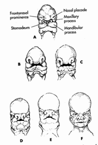 พัฒนาการของใบหน้ามนุษย์ขณะอยู่ในท้องแม่